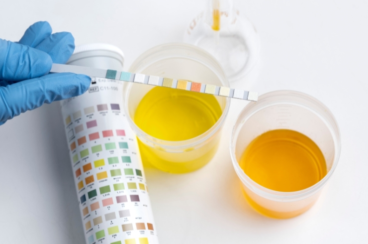 URINE TEST